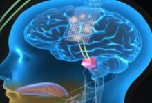 A mind-reading AI device that can write down your thoughts on your computer.