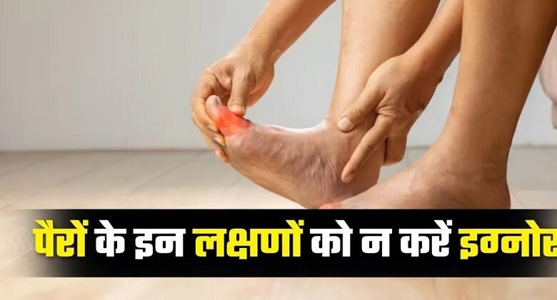 DiabetesFootSymptoms