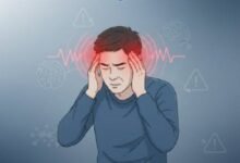 MigraineAwareness